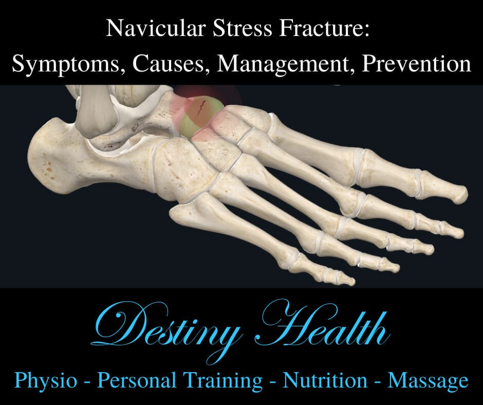 Understanding The Navicular Stress Fracture Destiny Health