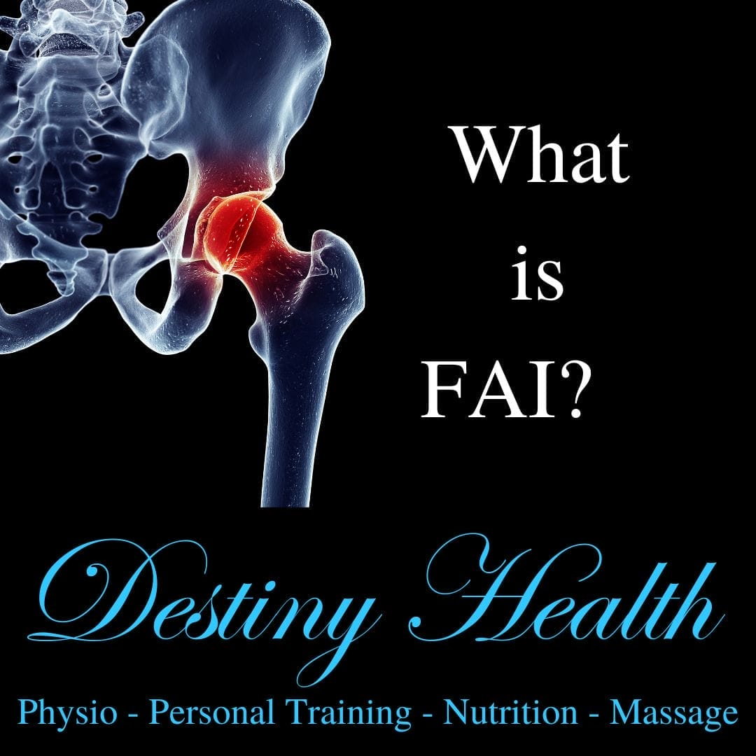 What is FAI and how does it cause hip pain? - Destiny Health